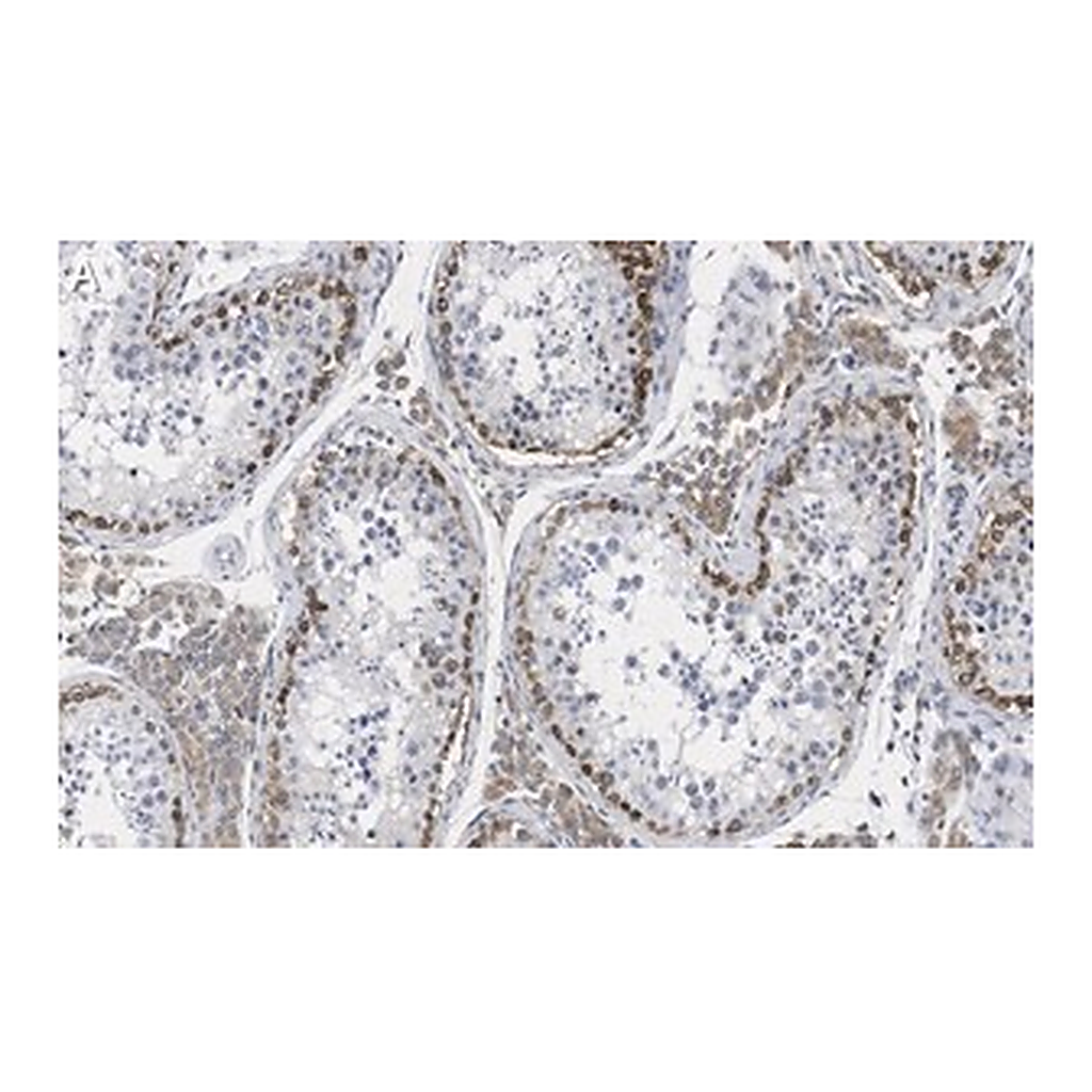Merck Anti-FMR1 (C-terminal) Antibody, clone 2B16 ZooMAb Rabbit Monoclonal