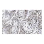 Merck Anti-FMR1 (C-terminal) Antibody, clone 2B16 ZooMAb Rabbit Monoclonal