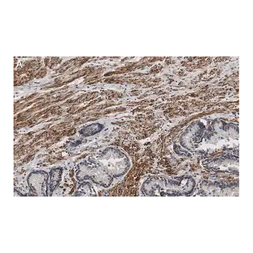 Merck Anti-Integrin beta 1 Antibody, clone HUTS-4 ZooMAb Mouse Monoclonal