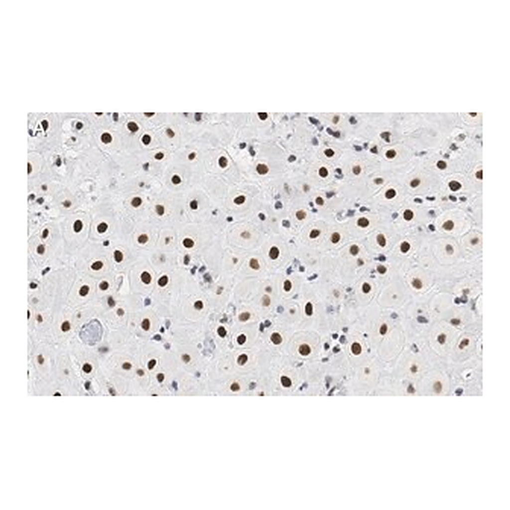 Merck Anti-BMI-1 Antibody, clone F6 ZooMAb Mouse Monoclonal