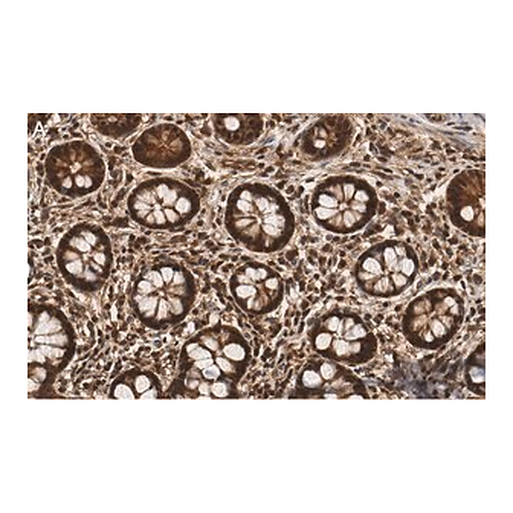 Merck Anti-PSMB2 Antibody, clone 2N18 ZooMAb Rabbit Monoclonal