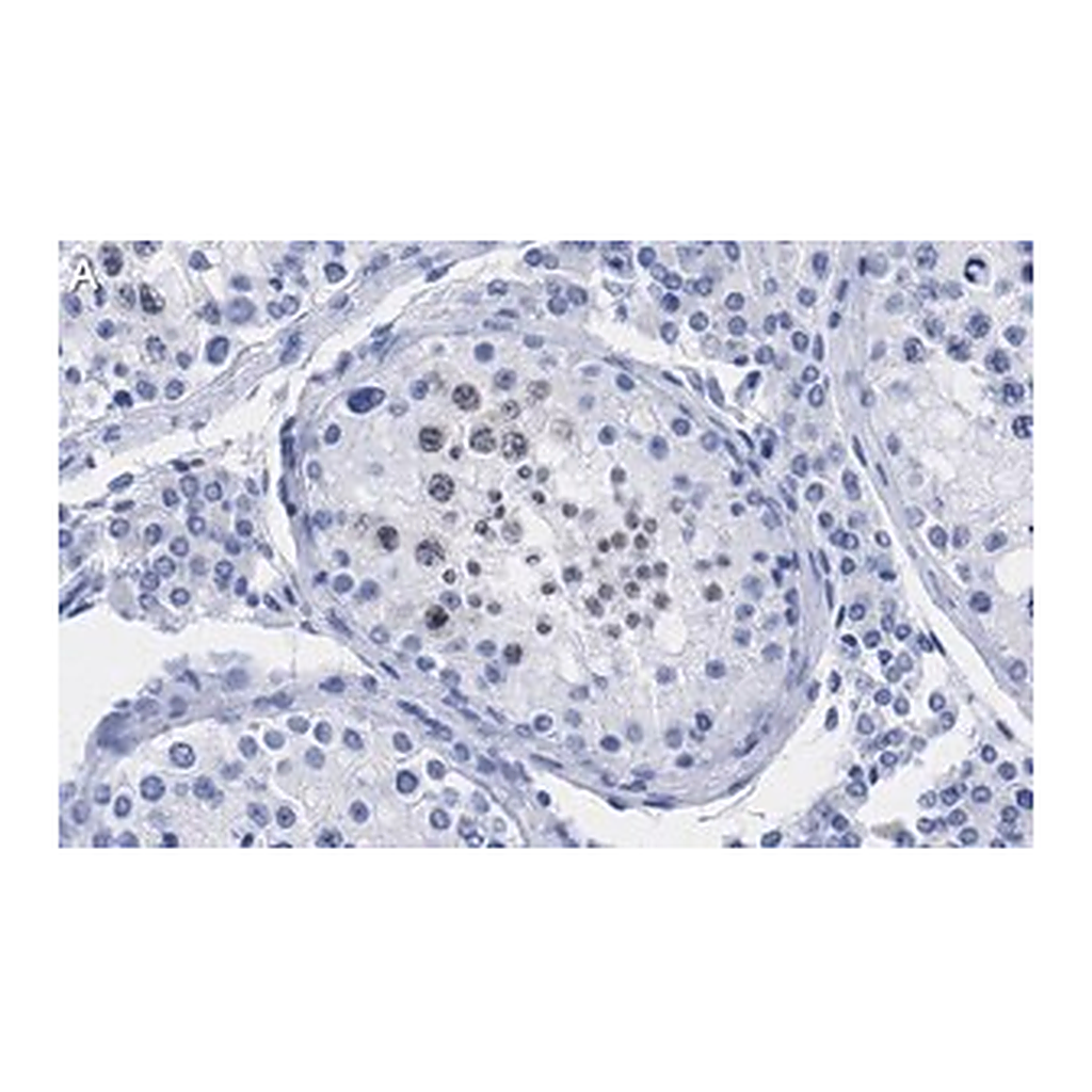Merck Anti-p14ARF Antibody, clone 4F19 ZooMAb Rabbit Monoclonal