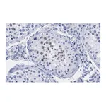 Merck Anti-p14ARF Antibody, clone 4F19 ZooMAb Rabbit Monoclonal