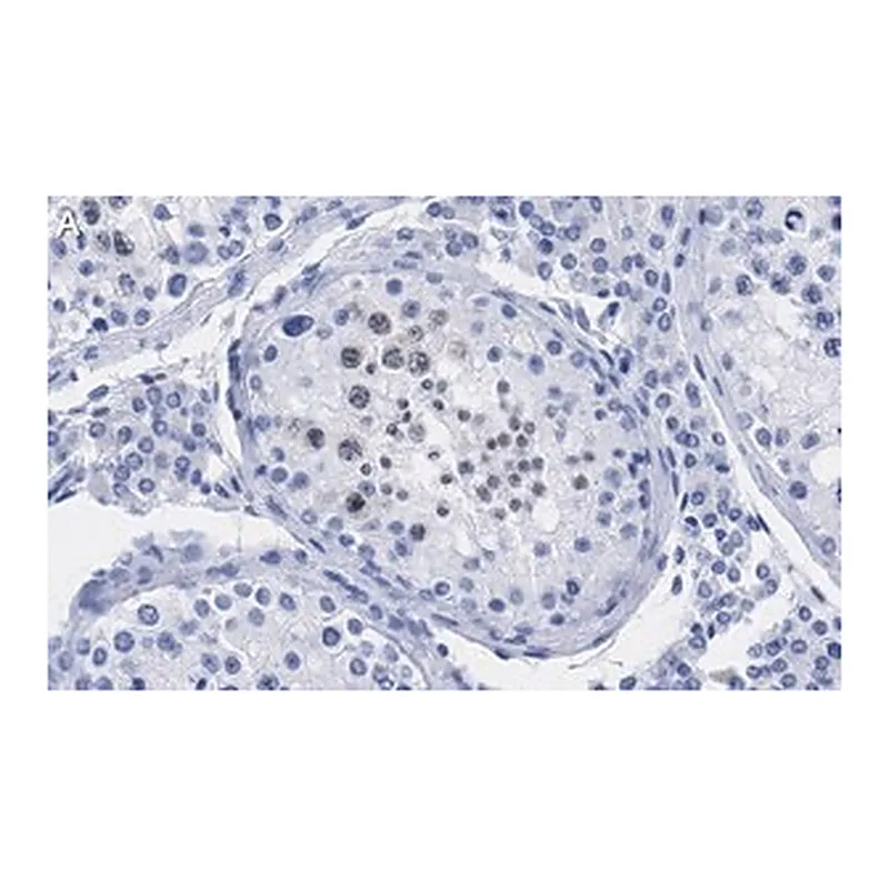 Merck Anti-p14ARF Antibody, clone 4F19 ZooMAb Rabbit Monoclonal