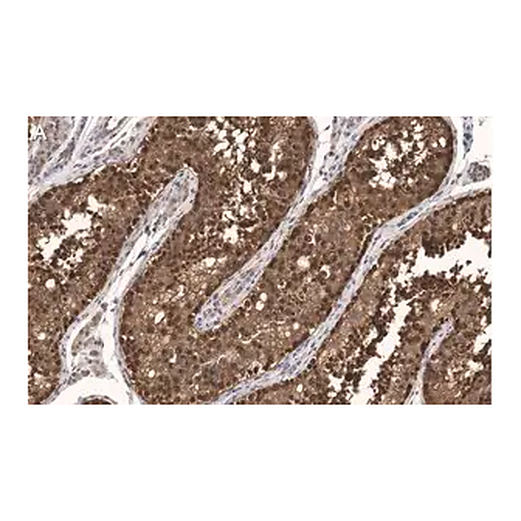 Merck Anti-FKBP52 Antibody, clone 4H21 ZooMAb Rabbit Monoclonal