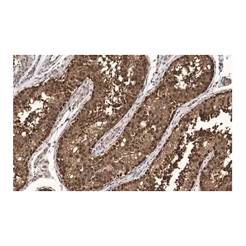 Merck Anti-FKBP52 Antibody, clone 4H21 ZooMAb Rabbit Monoclonal