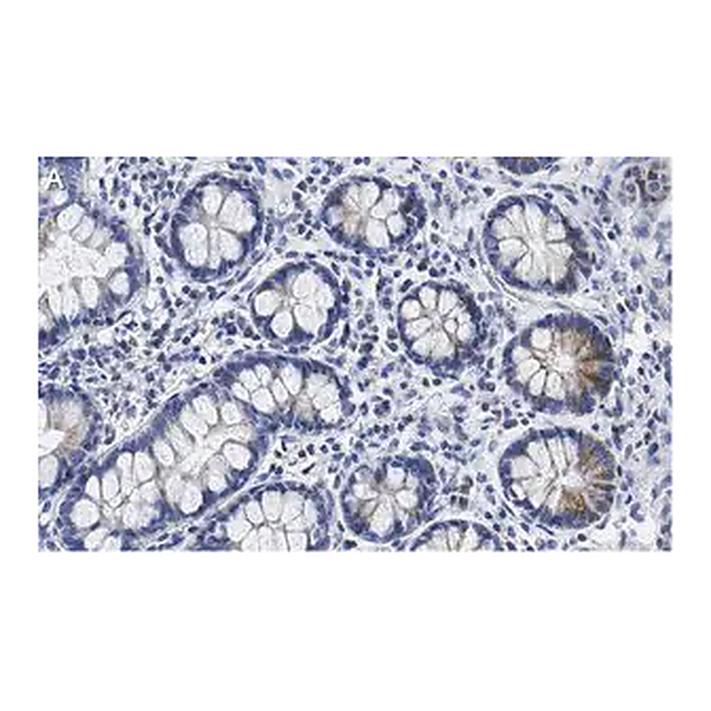 Merck Anti-SUPV3L1 Antibody, clone 2F5 ZooMAb Rabbit Monoclonal