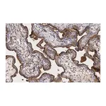 Merck Anti-Integrin α-5 Antibody, clone 5E18 ZooMAb Rabbit Monoclonal