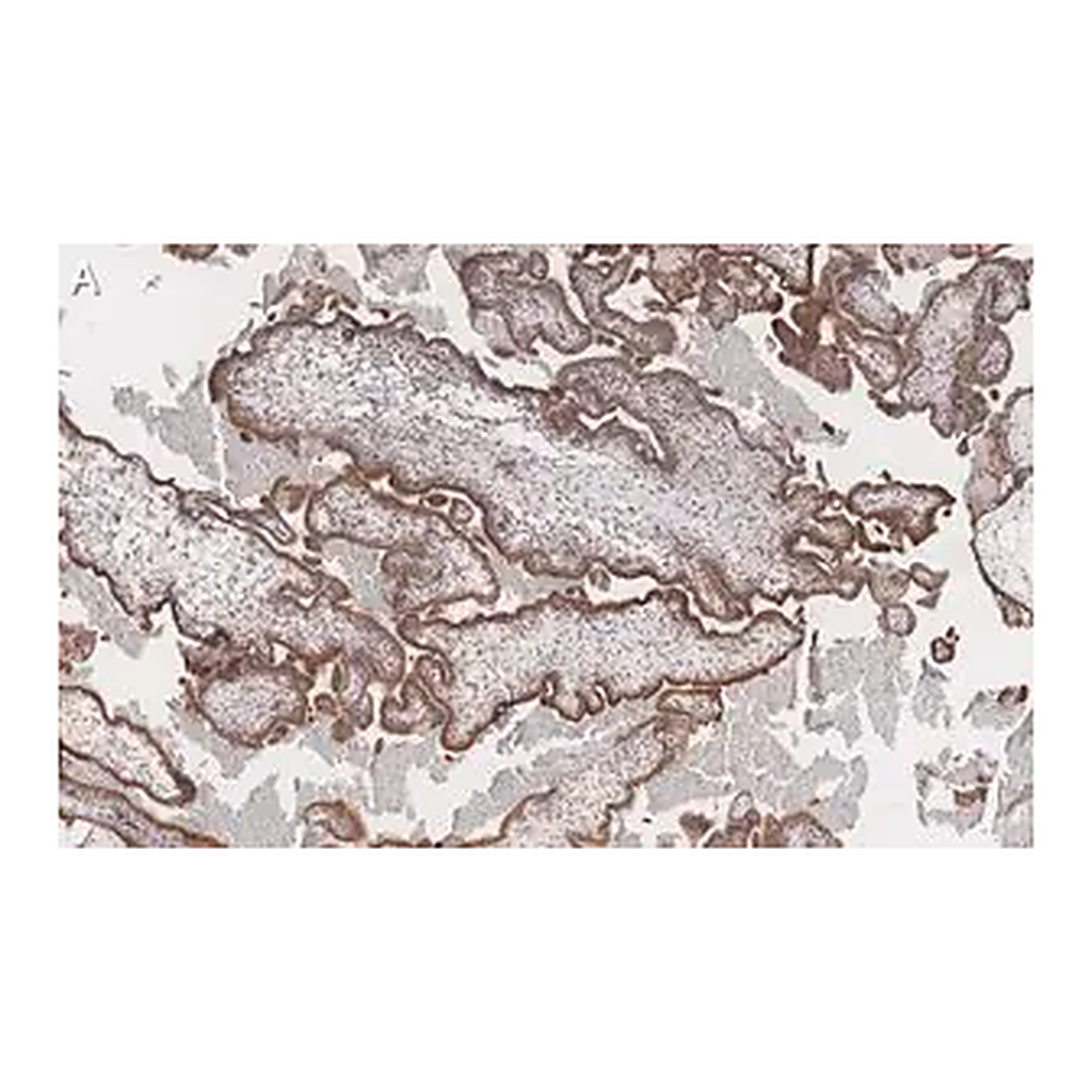 Merck Anti-FAK Antibody, clone 1D14 ZooMAb Rabbit Monoclonal