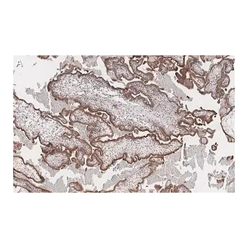 Merck Anti-FAK Antibody, clone 1D14 ZooMAb Rabbit Monoclonal