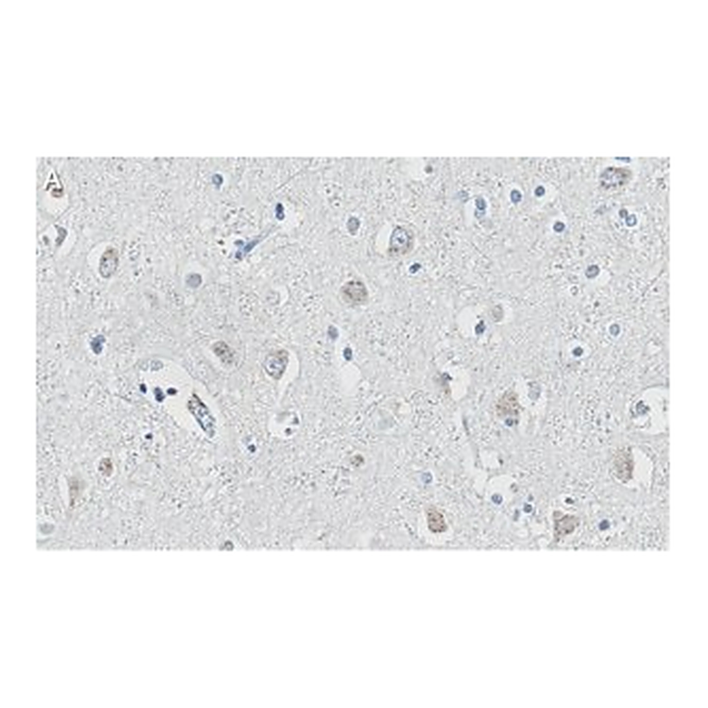Merck Anti-APP Antibody, clone 1F22 ZooMAb Rabbit Monoclonal