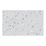 Merck Anti-APP Antibody, clone 1F22 ZooMAb Rabbit Monoclonal