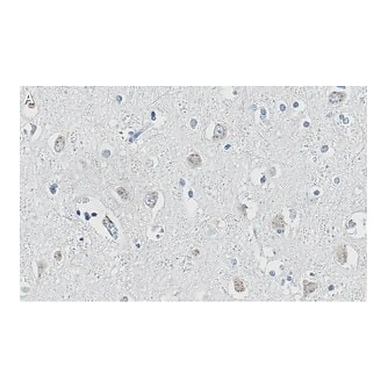 Merck Anti-APP Antibody, clone 1F22 ZooMAb Rabbit Monoclonal