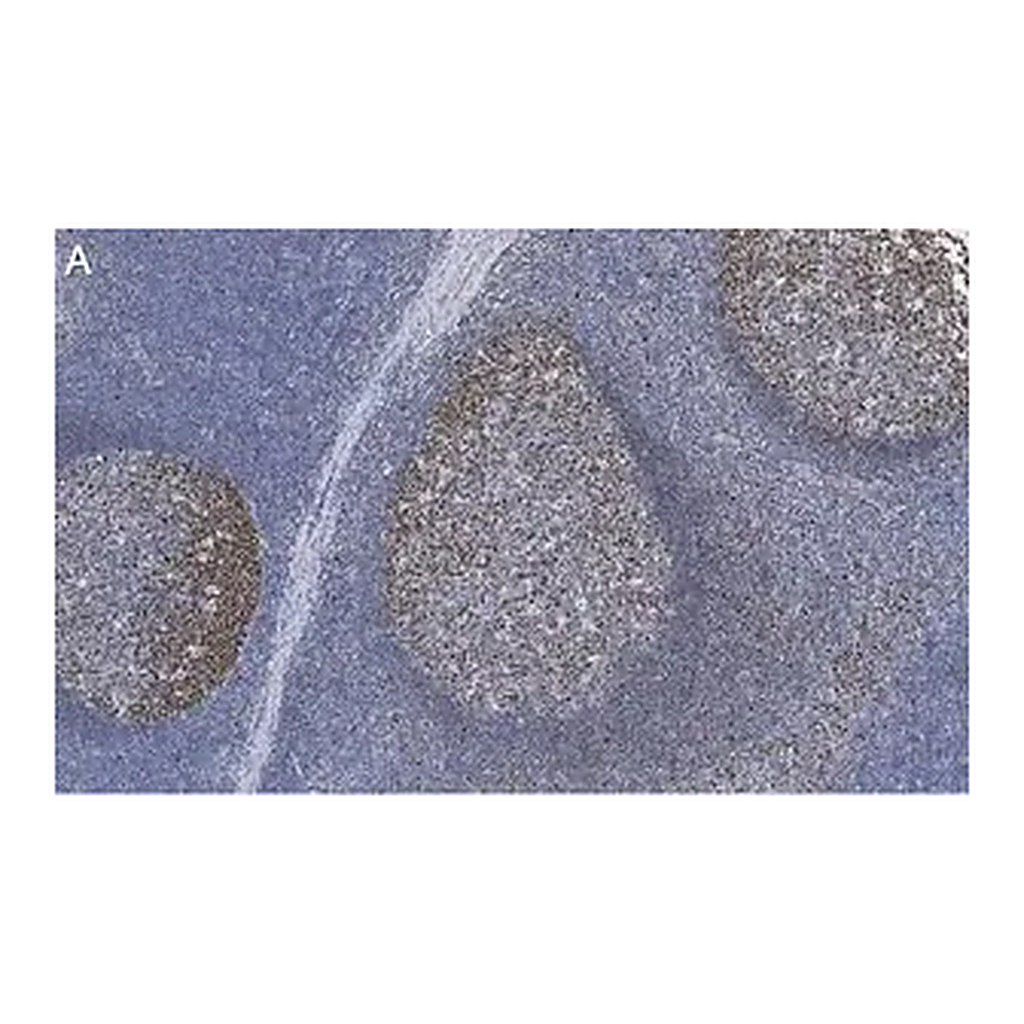 Merck Anti-Rb Antibody, clone 2M15 ZooMAb Rabbit Monoclonal