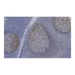 Merck Anti-Rb Antibody, clone 2M15 ZooMAb Rabbit Monoclonal