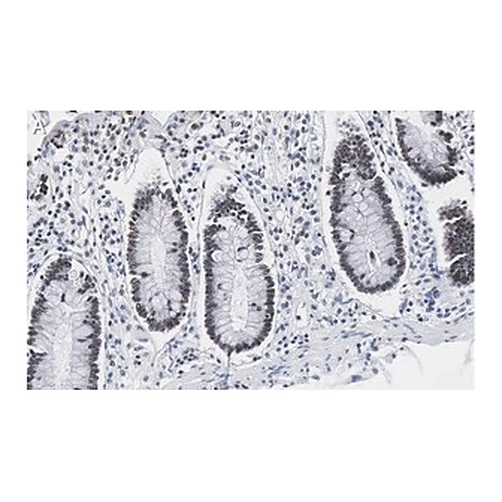 Merck Anti-PRPF19 Antibody, clone 1K10 ZooMAb Rabbit Monoclonal