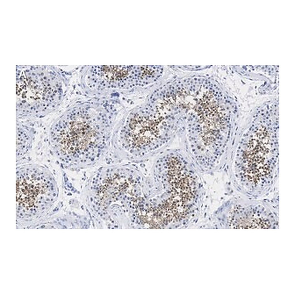 Merck Anti-PPP3CC Antibody, clone 2C2 ZooMAb Rabbit Monoclonal