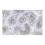 Merck Anti-PPP3CC Antibody, clone 2C2 ZooMAb Rabbit Monoclonal