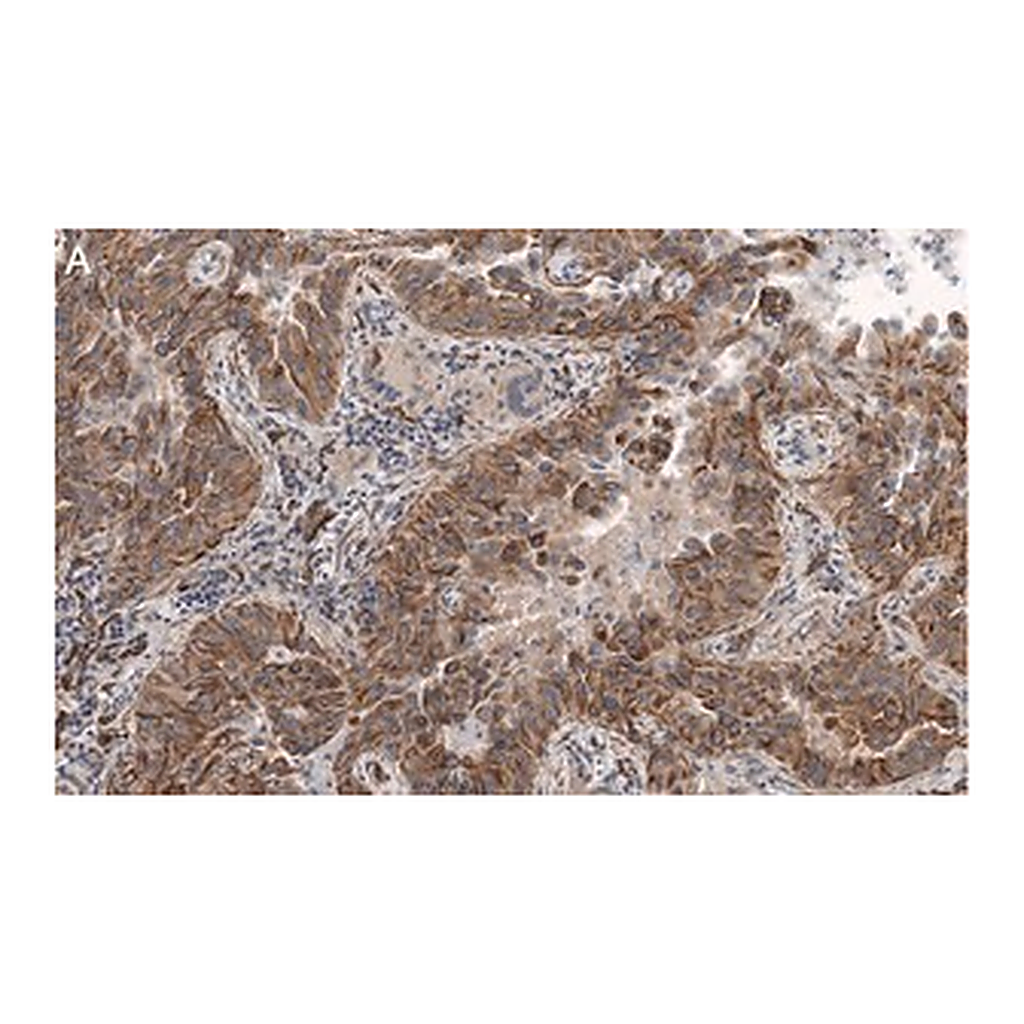 Merck Anti-MICB Antibody, clone 2K9 ZooMAb Rabbit Monoclonal