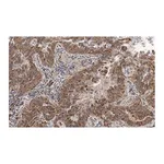 Merck Anti-MICB Antibody, clone 2K9 ZooMAb Rabbit Monoclonal