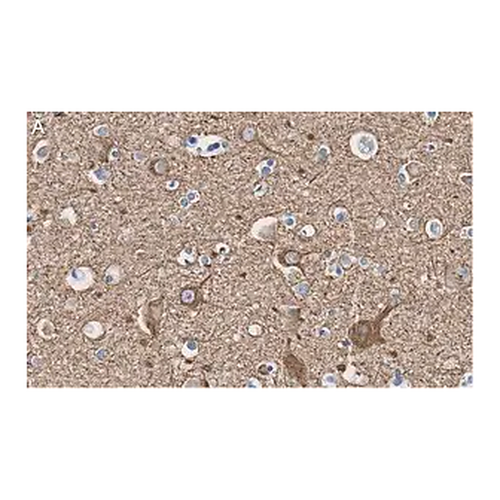 Merck Anti-Neurofilament L Antibody, clone 1E13 ZooMAb Rabbit Monoclonal
