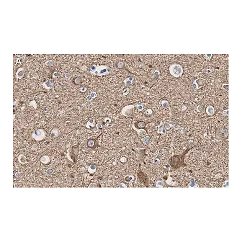 Merck Anti-Neurofilament L Antibody, clone 1E13 ZooMAb Rabbit Monoclonal