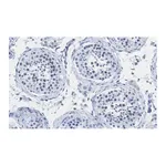 Merck Anti-PIAS Antibody, clone 1O17 ZooMAb Rabbit Monoclonal