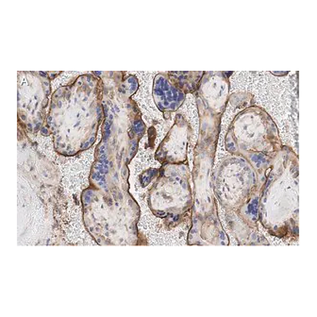 Merck Anti-GNA-11 (G alpha 11) Antibody, clone 1F16 ZooMAb Rabbit Monoclonal