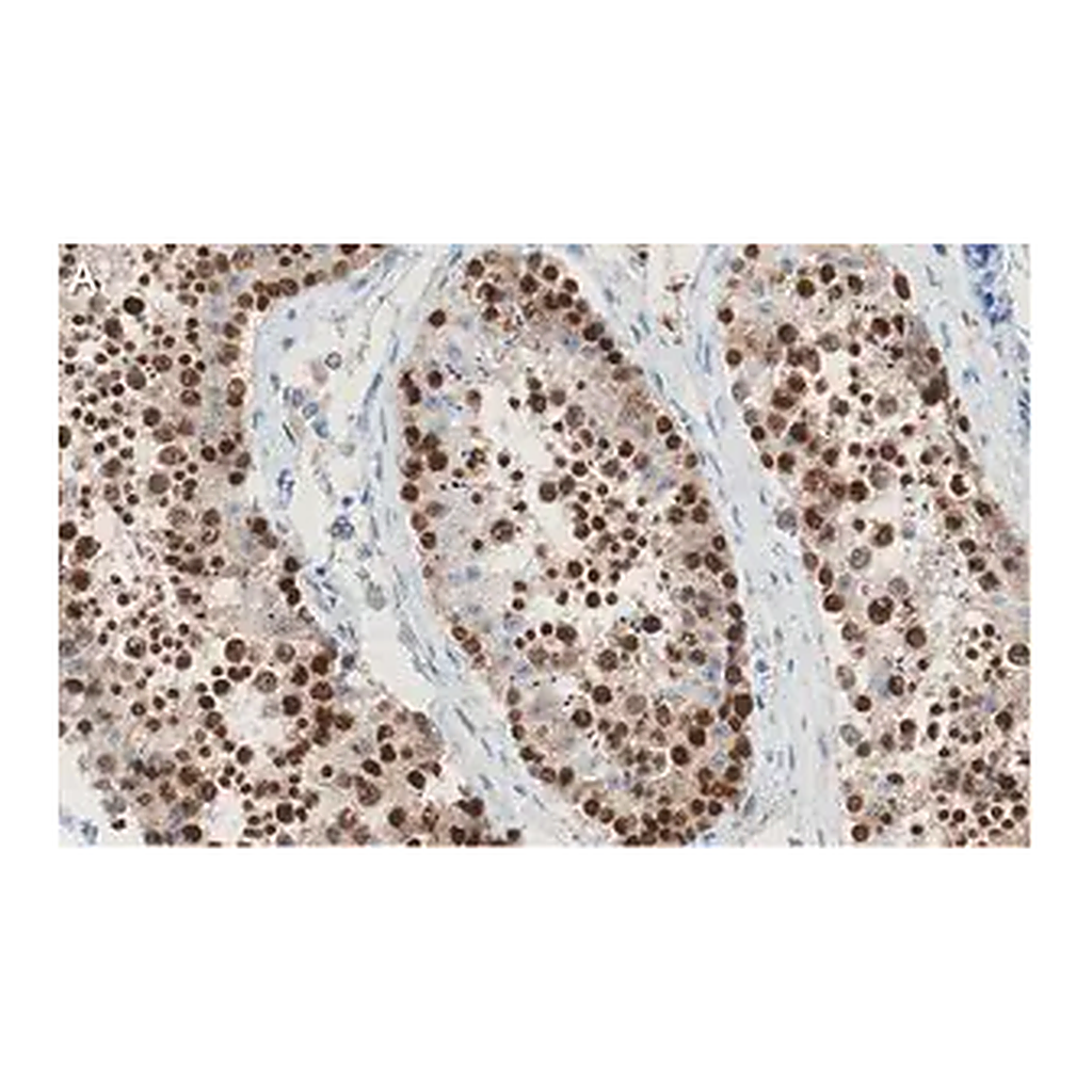 Merck Anti-REST Antibody, clone 2E3 ZooMAb Rabbit Monoclonal