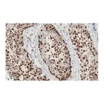 Merck Anti-REST Antibody, clone 2E3 ZooMAb Rabbit Monoclonal