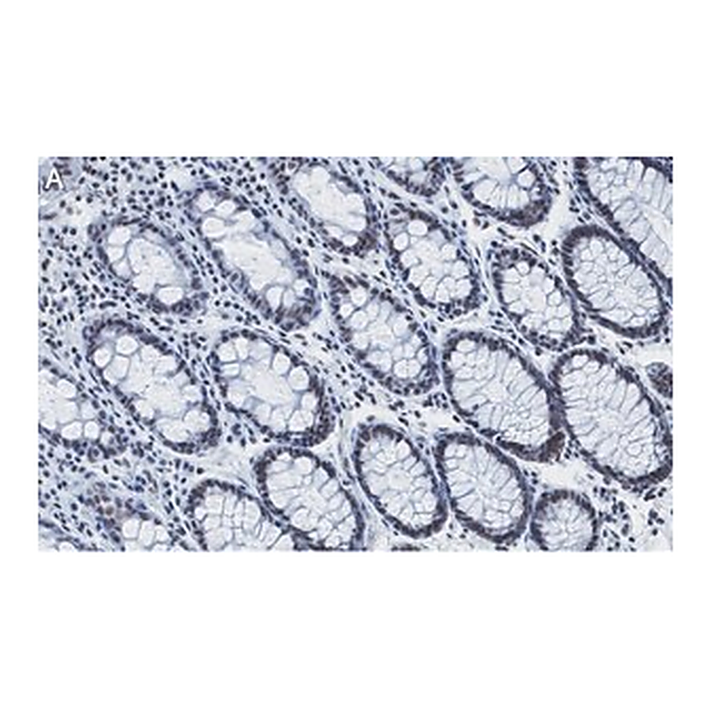 Merck Anti-RAD21 Antibody, clone 2H12 ZooMAb Rabbit Monoclonal