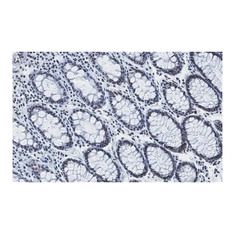 Merck Anti-RAD21 Antibody, clone 2H12 ZooMAb Rabbit Monoclonal