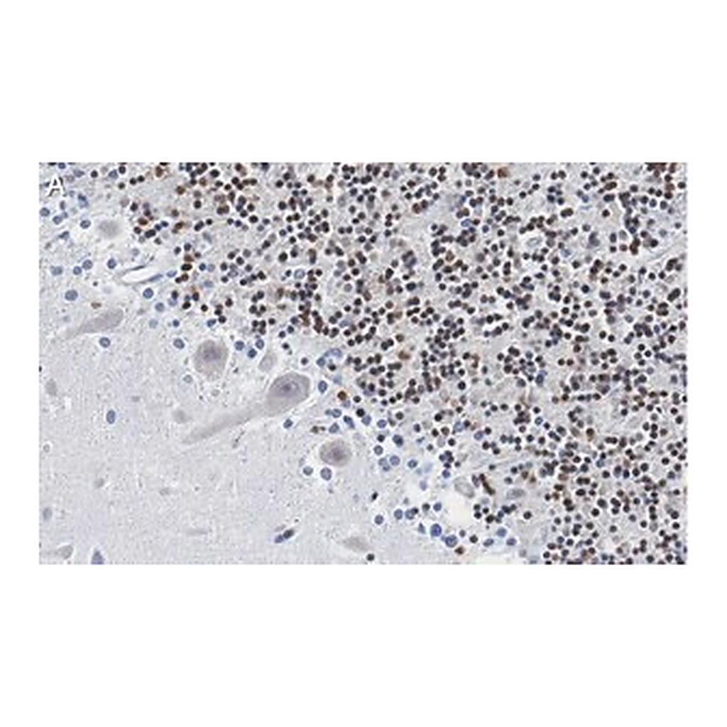 Merck Anti-DNA Polymerase beta Antibody, clone 3F21 ZooMAb Rabbit Monoclonal