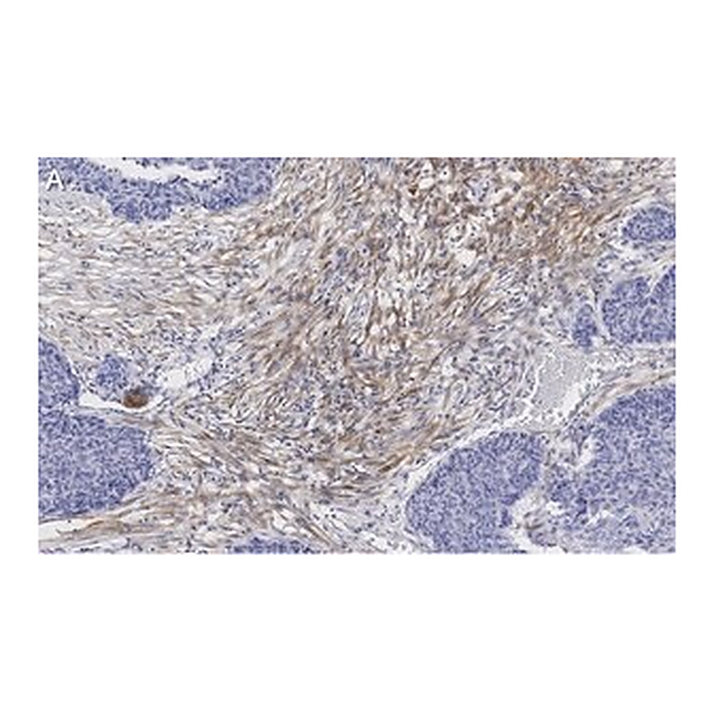 Merck Anti-Zyxin Antibody, clone 2F17 ZooMAb Rabbit Monoclonal