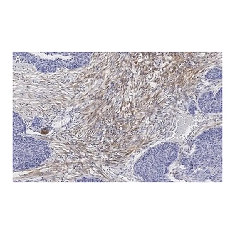 Merck Anti-Zyxin Antibody, clone 2F17 ZooMAb Rabbit Monoclonal