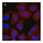 Merck Anti-p-Ubiquitin (pSer65) Antibody, clone 2N21 ZooMAb Rabbit Monoclonal