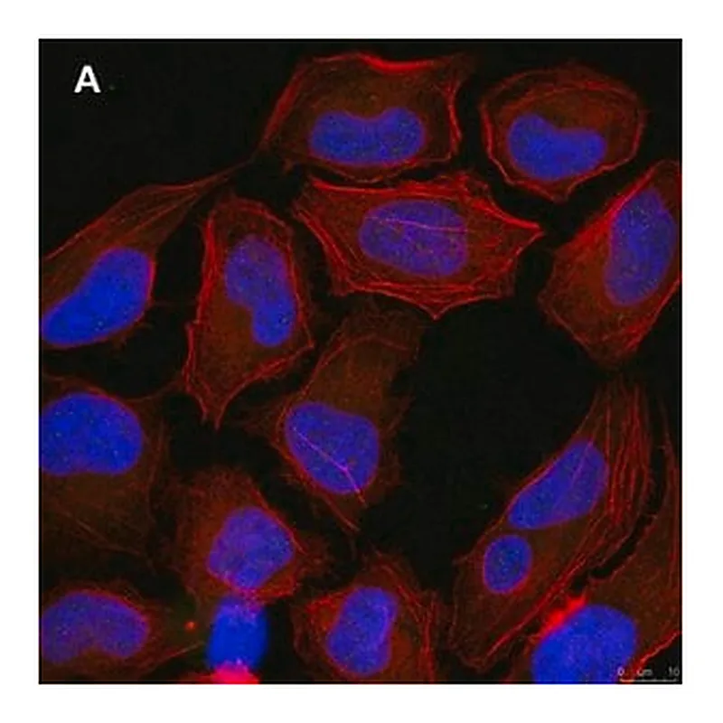 Merck Anti-p-Ubiquitin (pSer65) Antibody, clone 2N21 ZooMAb Rabbit Monoclonal