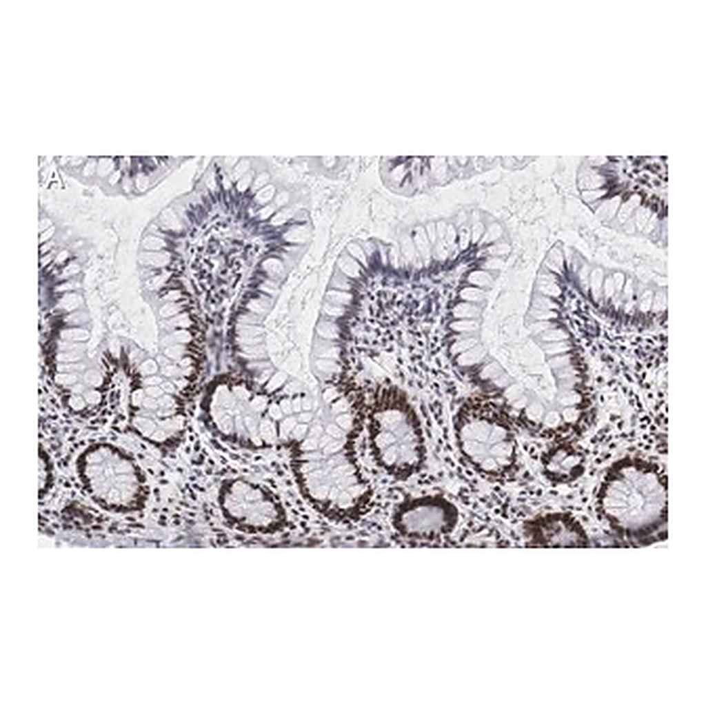 Merck Anti-Nucleolin Antibody, clone 5D13 ZooMAb Rabbit Monoclonal