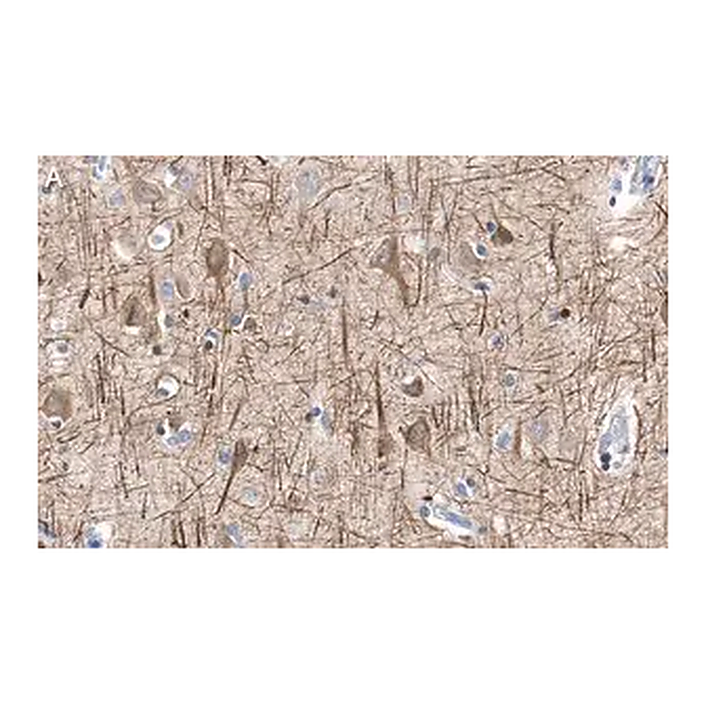 Merck Anti-Neurofilament H Antibody, clone 2N19 ZooMAb Rabbit Monoclonal
