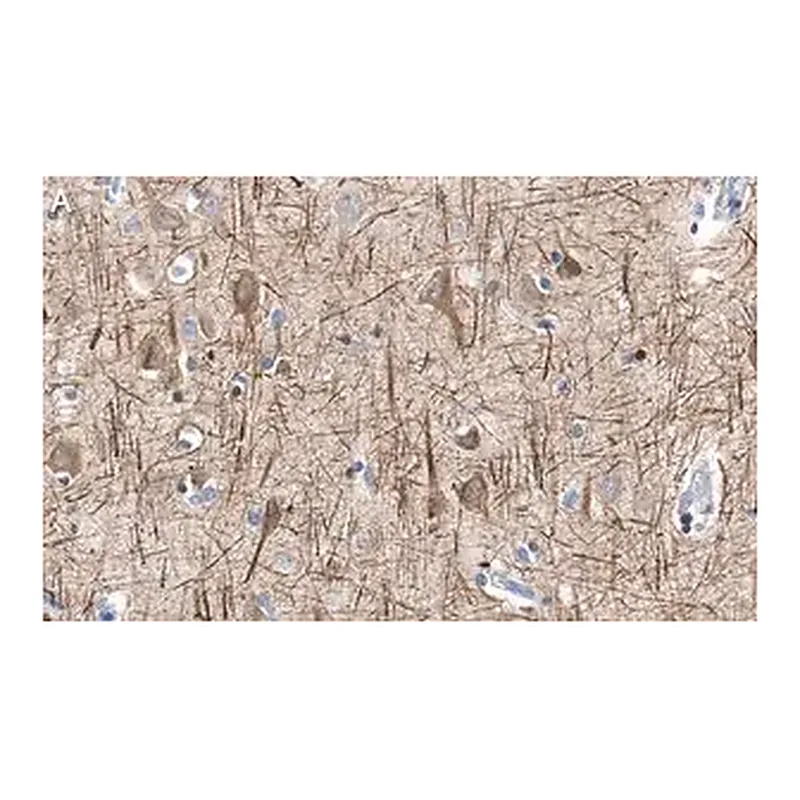 Merck Anti-Neurofilament H Antibody, clone 2N19 ZooMAb Rabbit Monoclonal