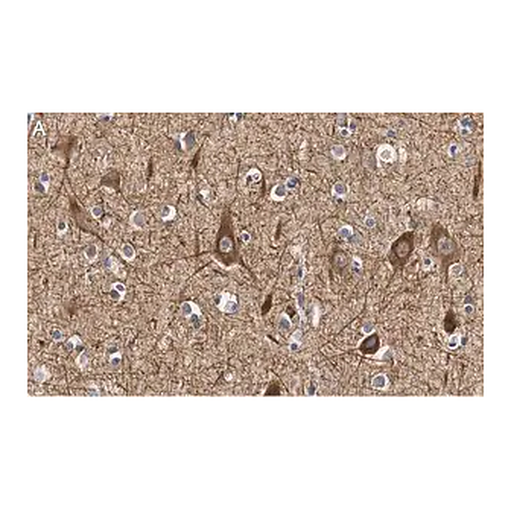 Merck Anti-Neurofilament M Antibody, clone 1B23 ZooMAb Rabbit Monoclonal