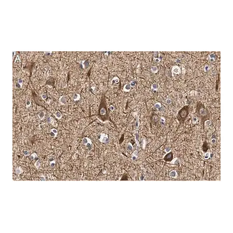 Merck Anti-Neurofilament M Antibody, clone 1B23 ZooMAb Rabbit Monoclonal