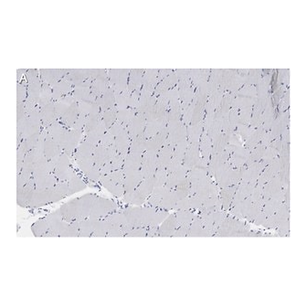 Merck Anti-Myosin Heavy Chain 7 Antibody, clone 1B19, ZooMAb Rabbit Monoclonal
