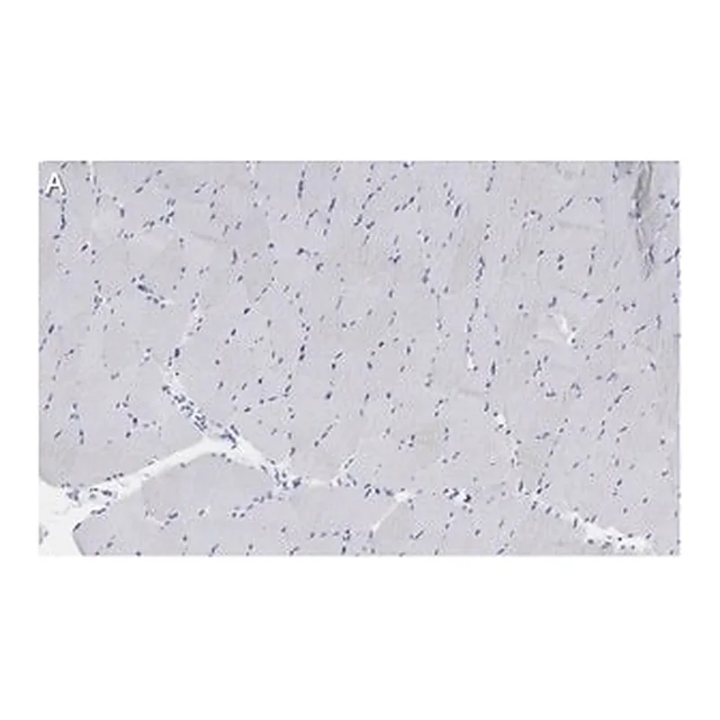 Merck Anti-Myosin Heavy Chain 7 Antibody, clone 1B19, ZooMAb Rabbit Monoclonal