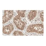 Merck Anti-Anillin Antibody, clone 2C6 ZooMAb Rabbit Monoclonal