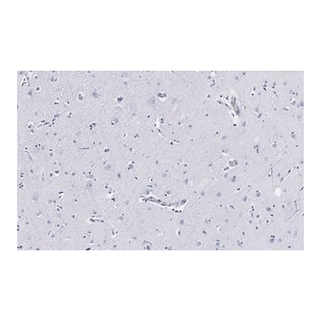 Merck Anti-Neurofilament H Antibody, clone 5L10, ZooMAb Rabbit Monoclonal