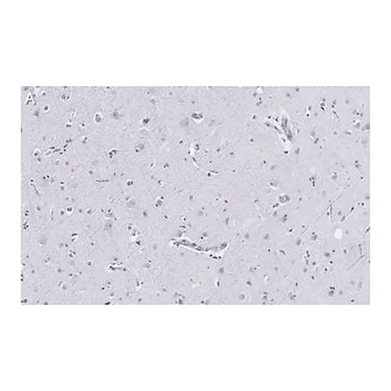 Merck Anti-Neurofilament H Antibody, clone 5L10, ZooMAb Rabbit Monoclonal