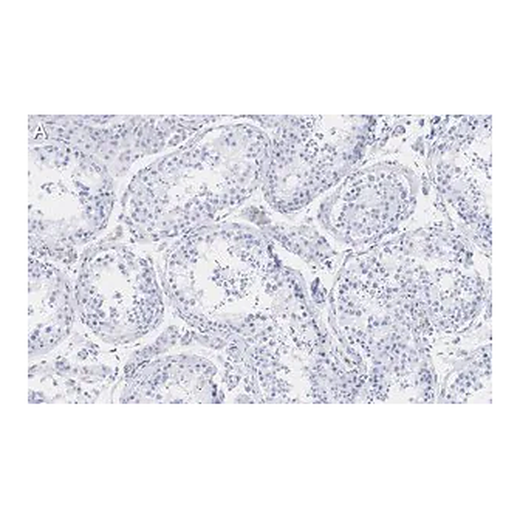 Merck Anti-Pericentrin Antibody, clone 2H11, ZooMAb Rabbit Monoclonal