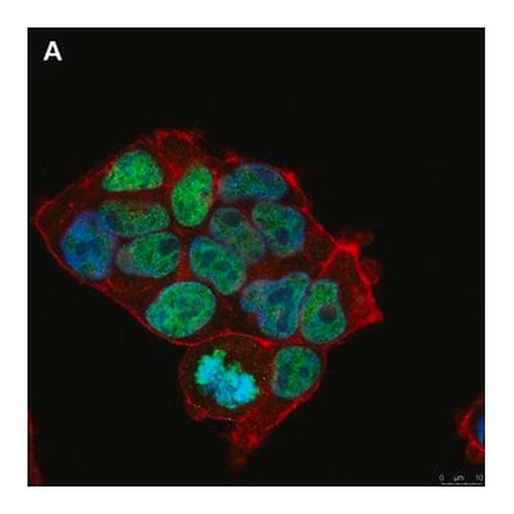 Merck Anti-Histone H3.3 G34R Antibody, clone 2L10 ZooMAb Rabbit Monoclonal