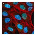 Merck Anti-NCOA1 Antibody, clone 5B9, ZooMAb Rabbit Monoclonal